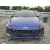 2021 HYUNDAI ELANTRA KMHLN4AG8MU159795 62756595