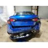 2025 NISSAN ALTIMA 1N4BL4DV0SN308164 74642295